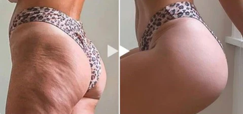 🔥Last Day SALE OFF 60%🔥 Nurbini™ Bust Enhancement & Bigger Glutes Lifting Oil 🍑 🎀 👙