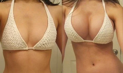 🔥Last Day SALE OFF 60%🔥 Nurbini™ Bust Enhancement & Bigger Glutes Lifting Oil 🍑 🎀 👙