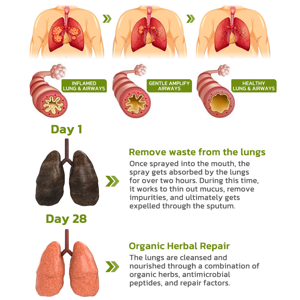Dobshow™ BreathDetox Herbal Lung Cleansing Spray🌿