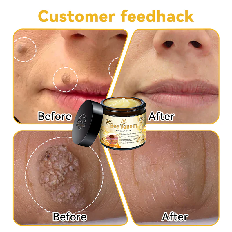 Turonu™ Bee Venom Skin Treatment Cream 🌿 Made in USA
