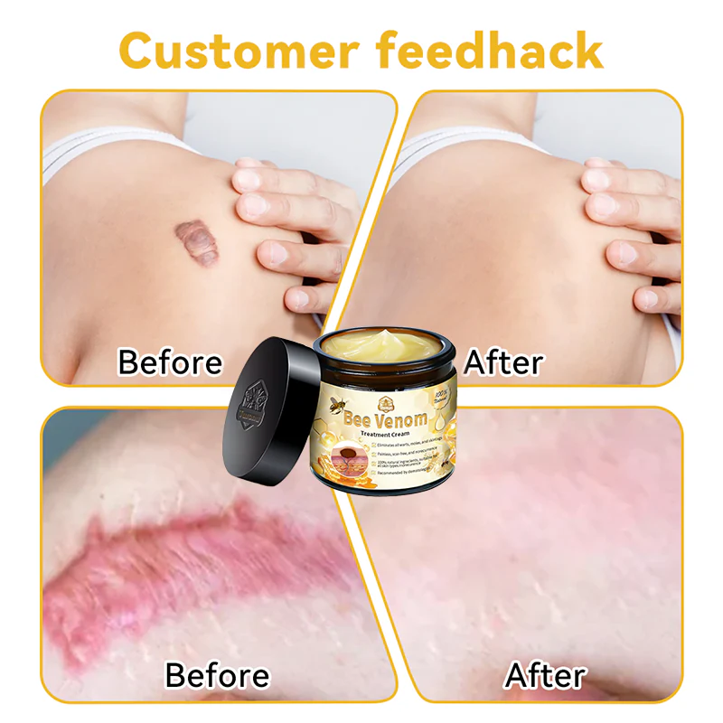 Turonu™ Bee Venom Skin Treatment Cream 🌿 Made in USA