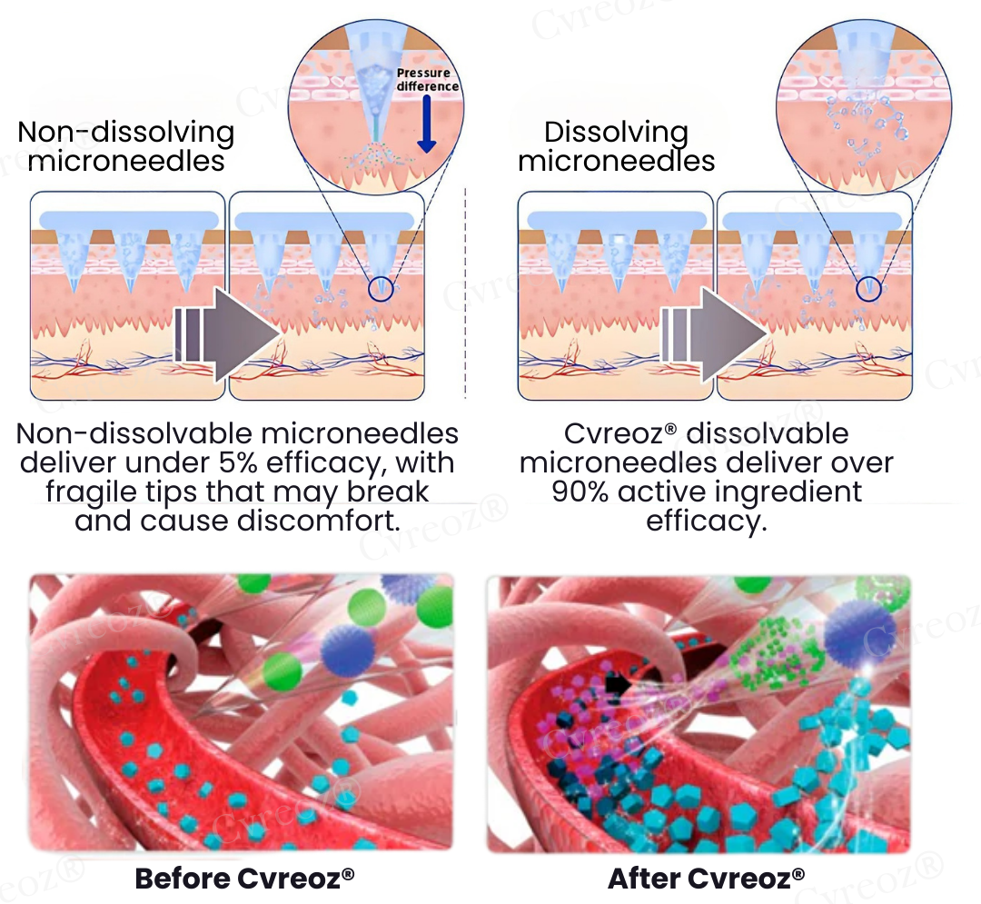 Cvreoz® InsuliNeedle Glucose Control Microneedling Patch
