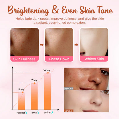 AEXZR® Whitening and Freckle - Removing Mask